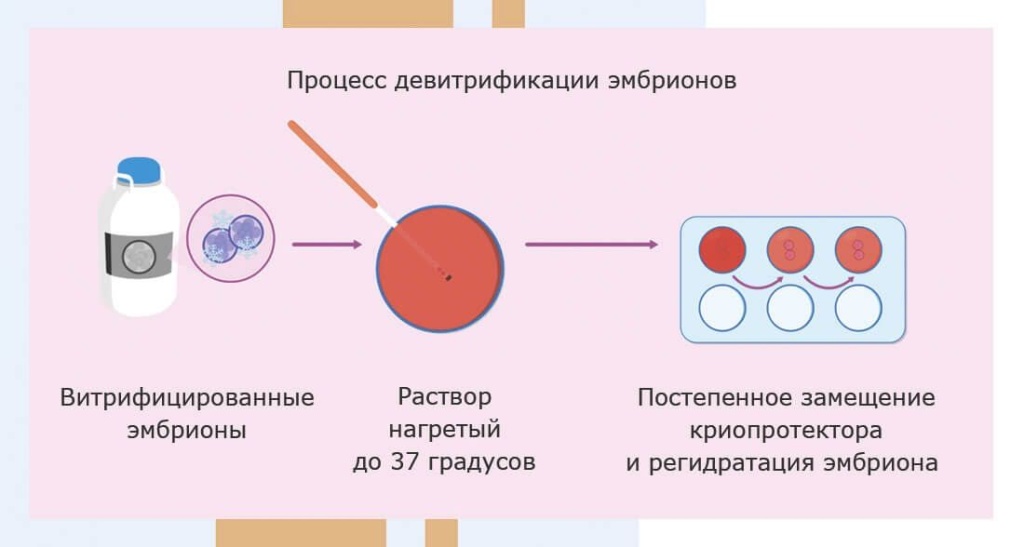 Процесс разморозки эмбрионов
